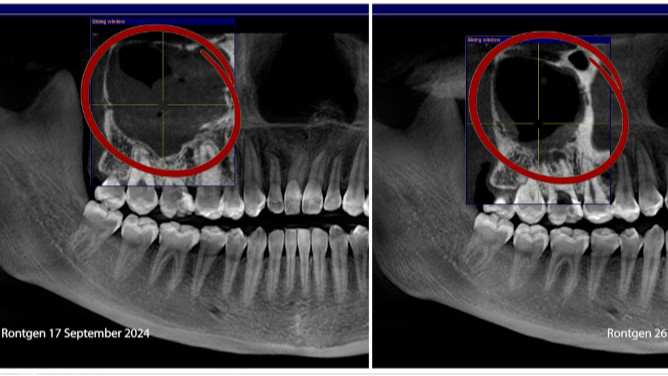 Dokumen Rotgen Devya Dental Clinic.