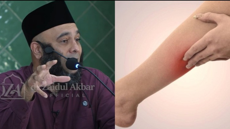 Sembuhkan asam urat menurut dr Zaidul Akbar