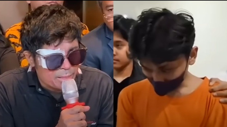 Alasan Aji siram air keras ke wajah Agus