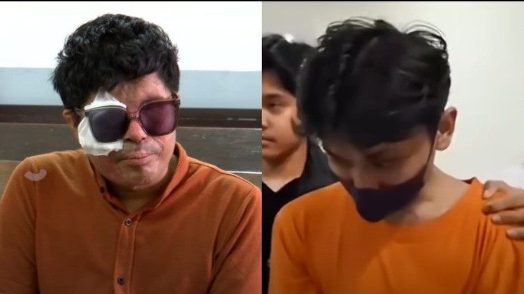 Aji akhirnya bicara jujur soal alasan siram air keras ke wajah Agus