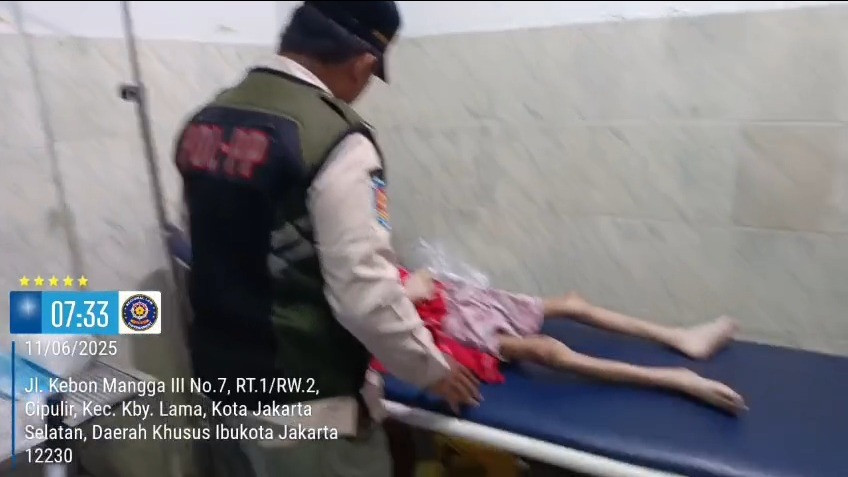 Mengenaskan, Pengakuan Bocah Perempuan Dibakar Hidup-hidup oleh Ayahnya: Diobati Terus Disiksa Lagi